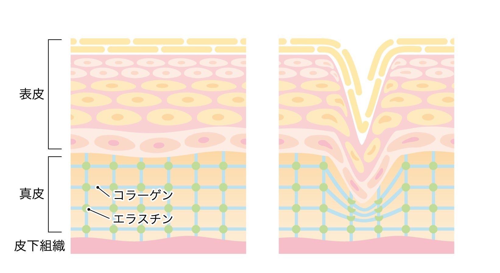 フェイスラインがぼやけてきたときに選ぶべき最初の美顔器はコチラのサブ画像2
