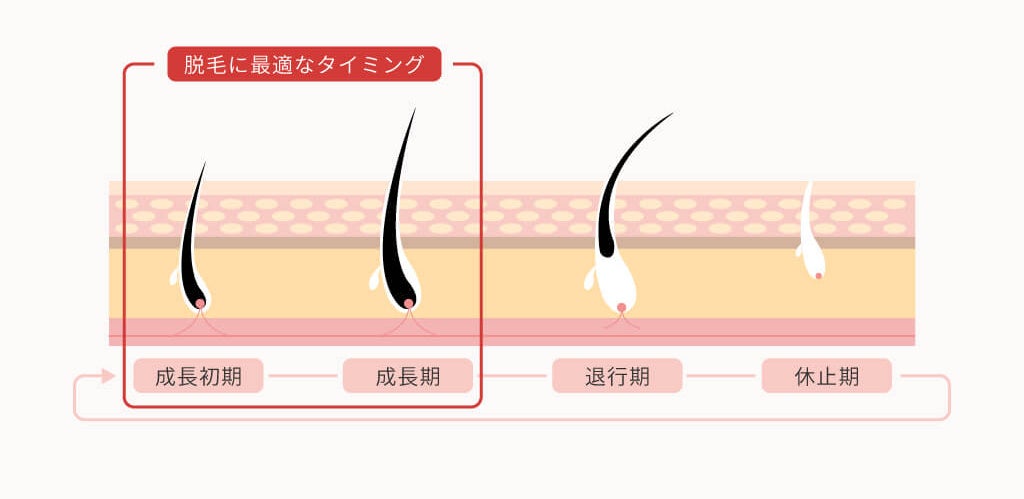 家庭用光美容器は効果が出るまでどれくらい？　頻度や効果などのムダ毛処理の疑問を解決のサブ画像3