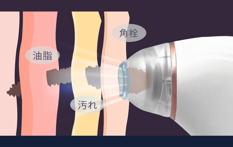 毛穴吸引器で角栓だらけの夏肌をレスキュー！　小鼻を引き締めて黒ずみを予防する効果的な使い方とはのサブ画像7