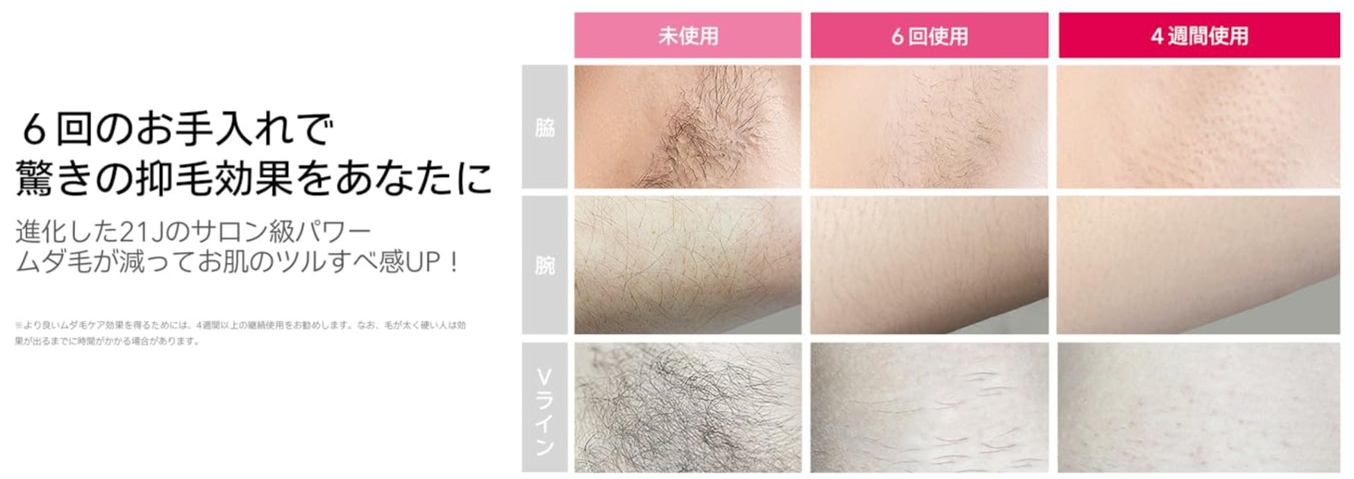 残りわずか１日！「Ulike」全品シリーズが実質最大36%OFFに！Amazonプライム感謝祭直前攻略！のサブ画像2