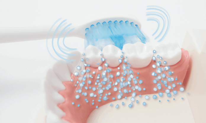 電動歯ブラシの効果は使い方次第! 歯ぐきが敏感な方にも最適な音波歯ブラシで口臭も予防のメイン画像